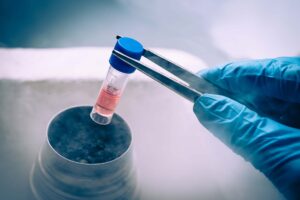 congelamento-de-ovulos-preservar-fertilidade-dr-jose-roberto-lambert-reproducao-assistida-santo-andre-sp