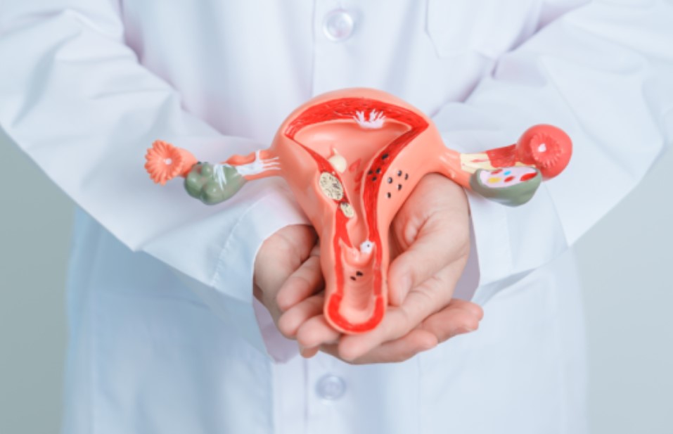 endometriose-o-que-e-dr-jose-roberto-lambert-reproducao-assistida-santo-andre-sp