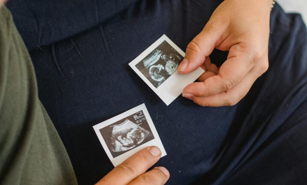 embrioes-congelados-chances-sucesso-ginecologista-dr-jose-roberto-lambert-reproducao-assistida-santo-andre-sp