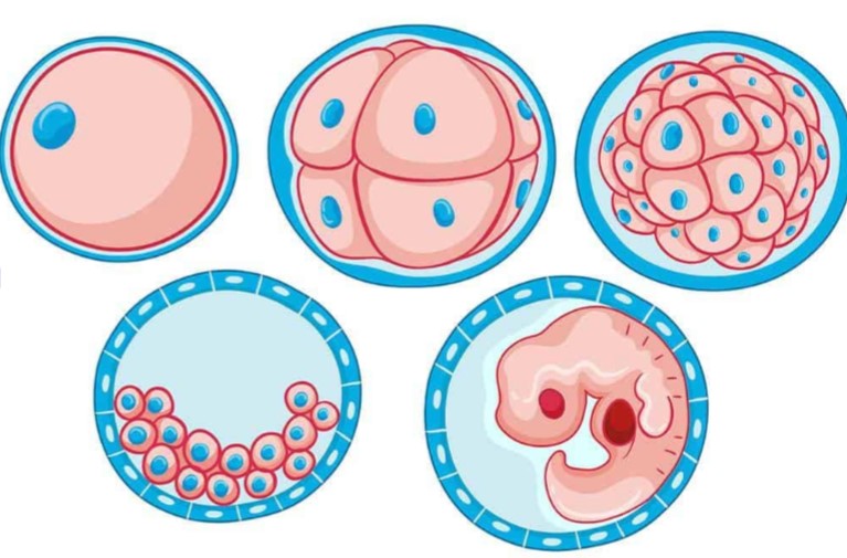 transferencia-embriao-fresco-ginecologista-dr-jose-roberto-lambert-reproducao-assistida-santo-andre-sp