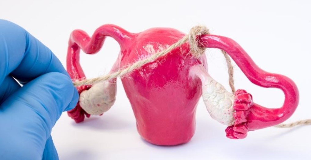 reverter-laqueadura-dr-jose-roberto-lambert-reproducao-assistida-santo-andre-sp